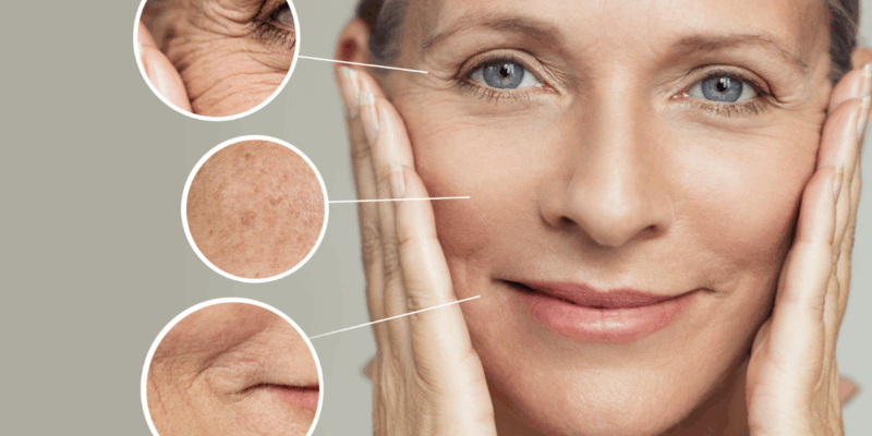 The Connection Between Menopause and Skin Changes
