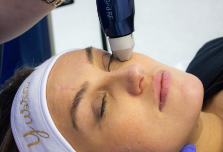 Microneedling with Skin Boosters UK | Dr Yusra Clinic Liverpool, Manchester, London