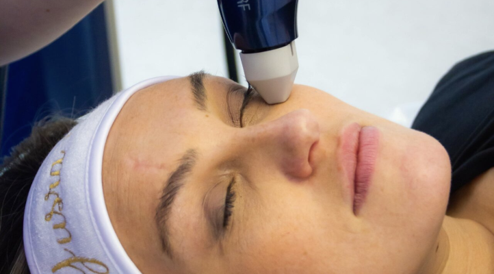 Microneedling with Skin Boosters UK | Dr Yusra Clinic Liverpool, Manchester, London