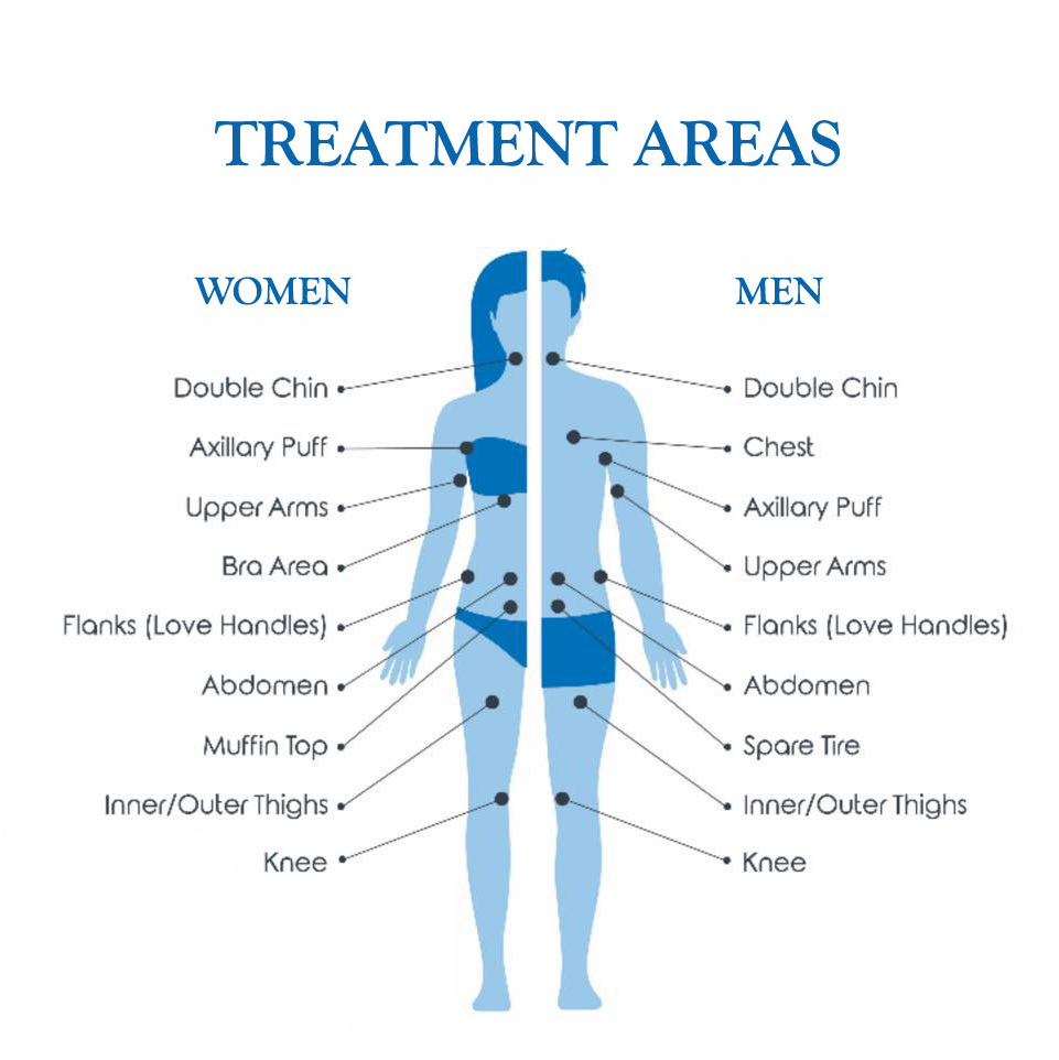 Areas for fat reduction treatment