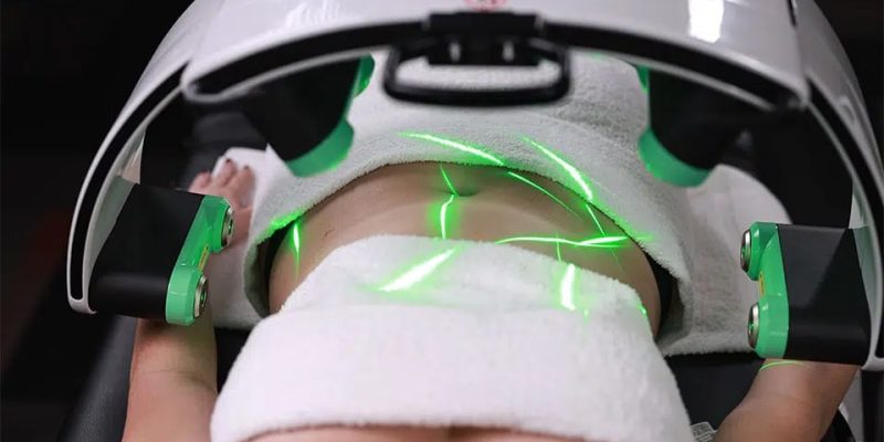 The-Benefits-of-Laser-Fat-Removal