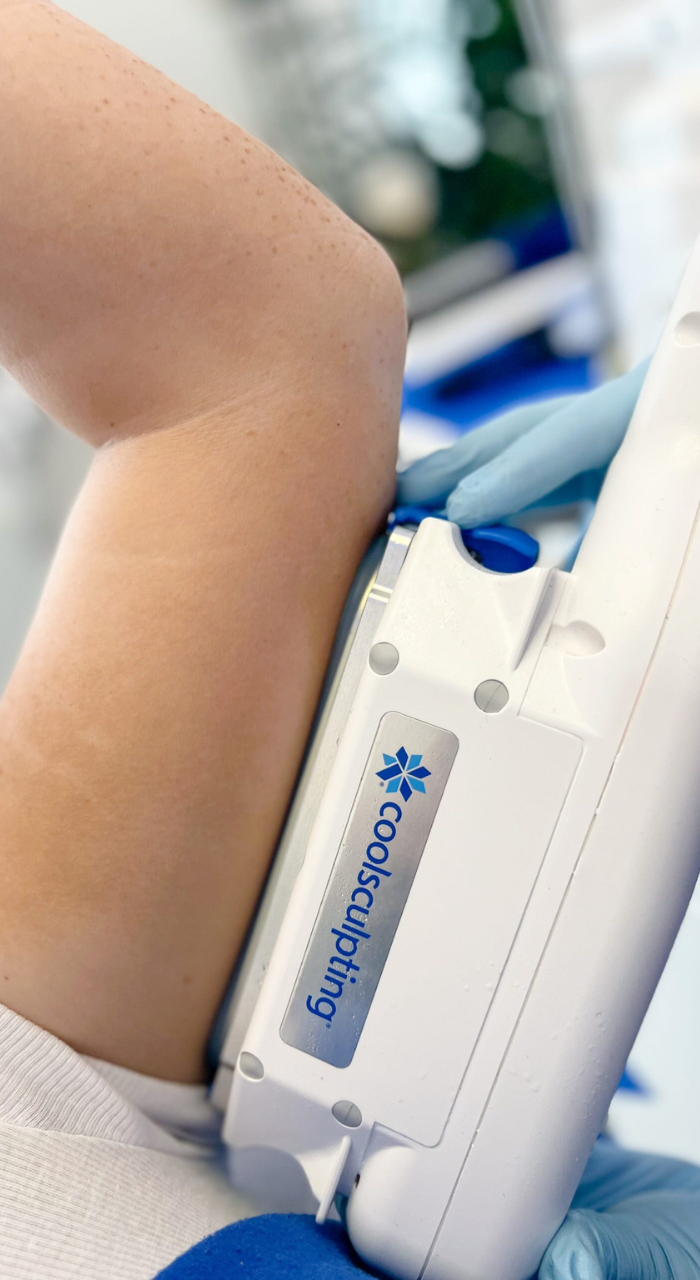 Is CoolSculpting Right for Me Liverpool