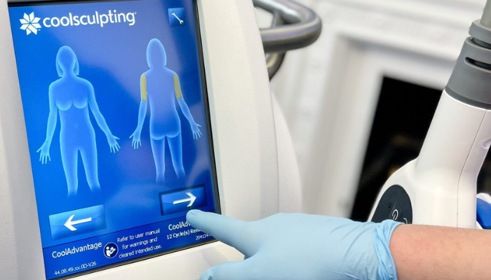What-is-Coolsculpting?