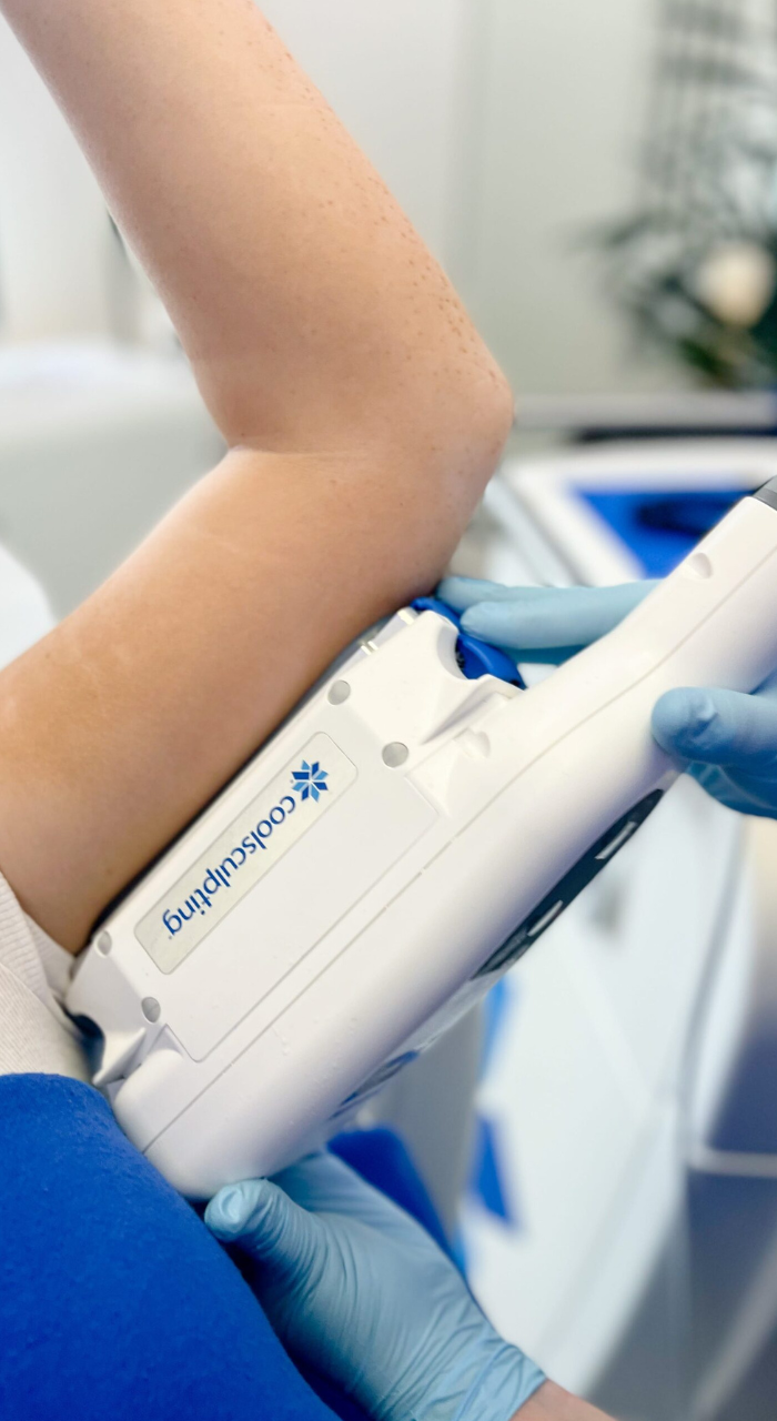 What is Liverpool CoolSculpting?